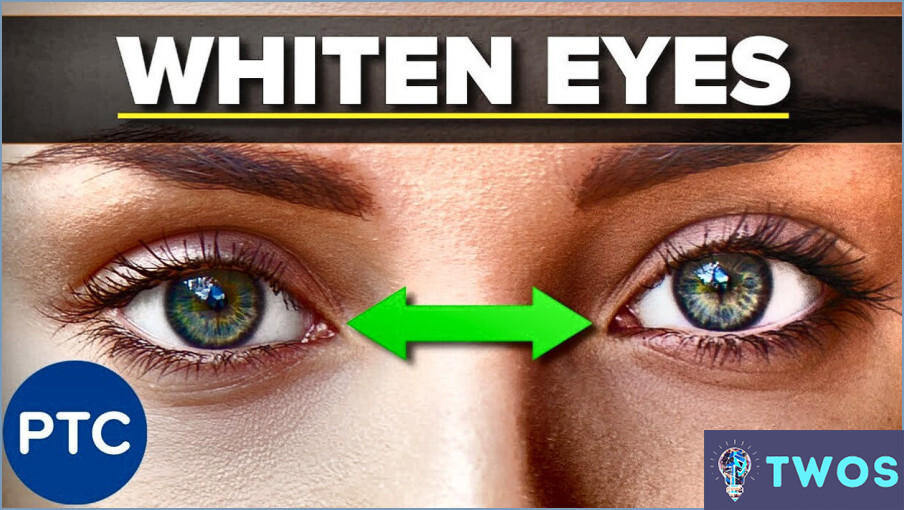 Su ¿Cómo puedo deshacerme de los ojos blancos en Photoshop?